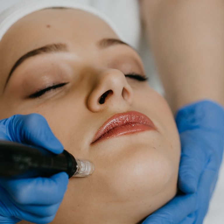 Il Laser Fraxel: un approccio rivoluzionario per la pelle perfetta | Dr. Marco Bartolucci