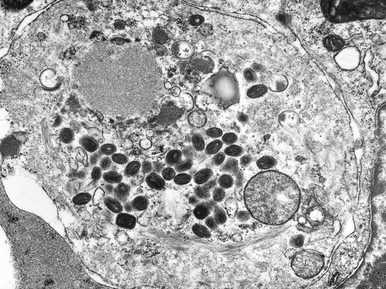 Il Peeling di Jessner: un approccio delicato all’esfoliazione cutanea