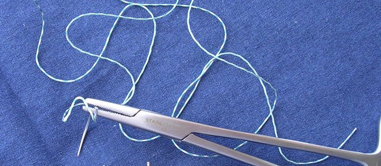 La Resilienza di Ann: Un’Analisi di “Il Merletto”