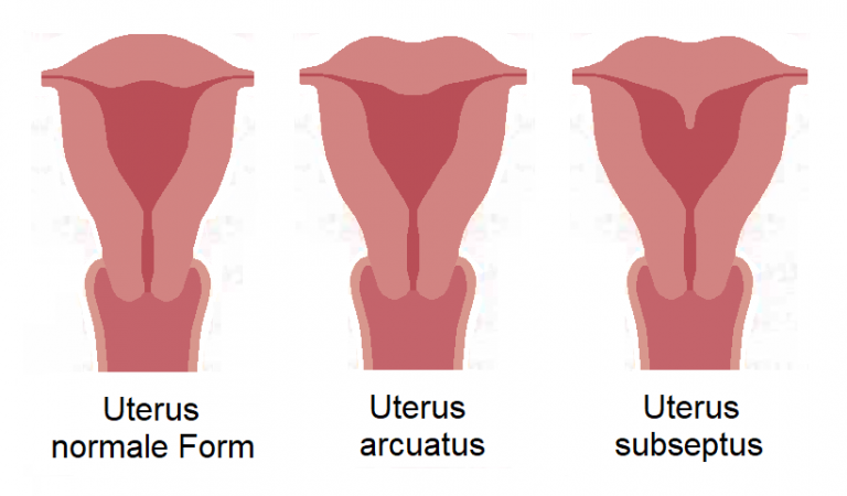 L’Impatto Emotivo e Psicologico dell’Endometriosi