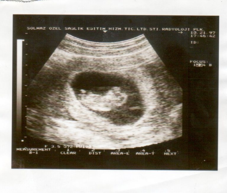 La dolce attesa di Paola Turani: un annuncio social e un sogno che si realizza