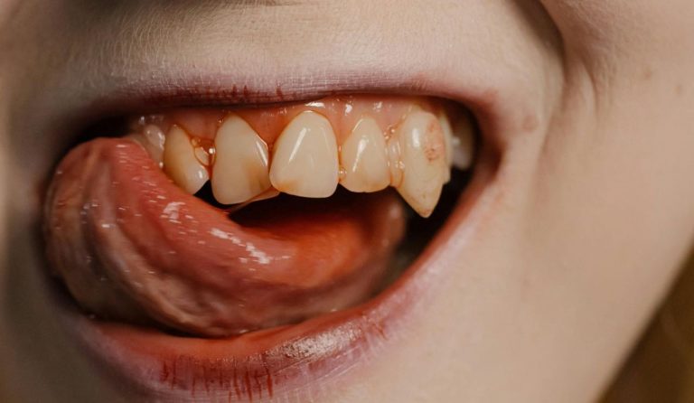 vampiri - pexels- emmepress